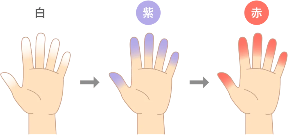 3-1-2_Img1