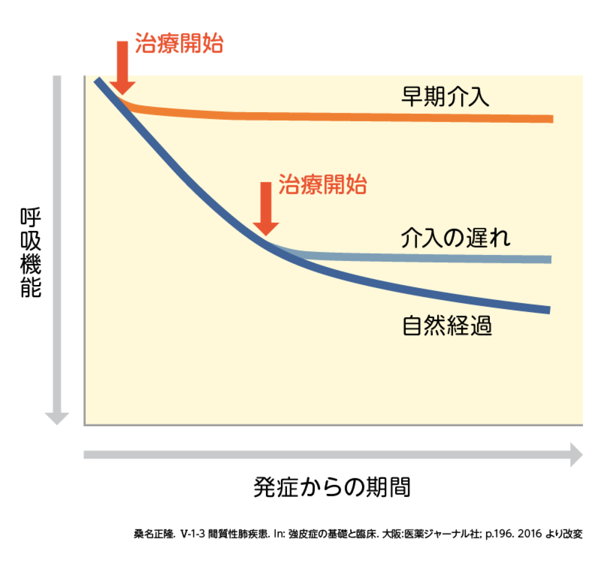 間質性肺疾患の治療目標
