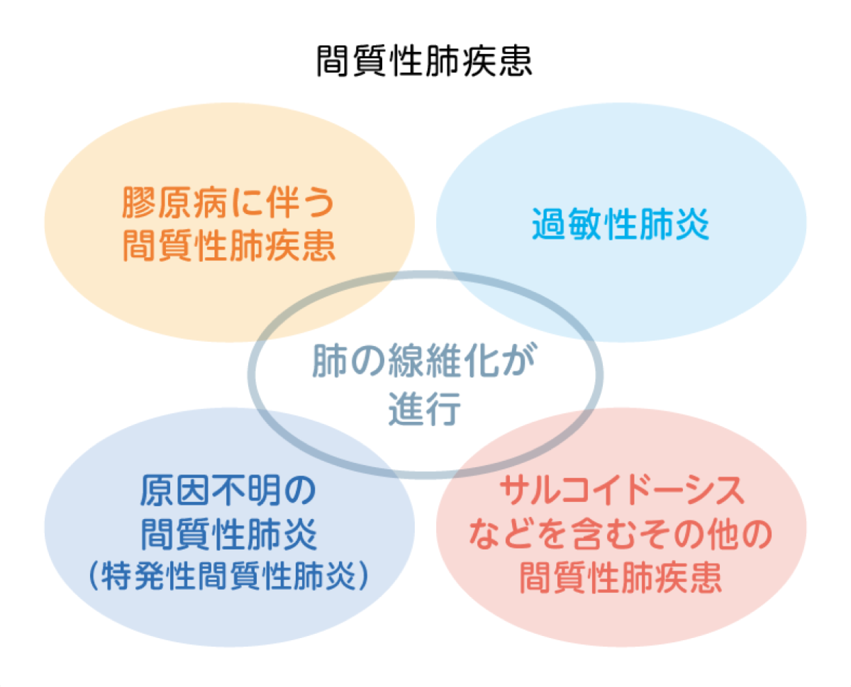 間質性肺疾患の原因