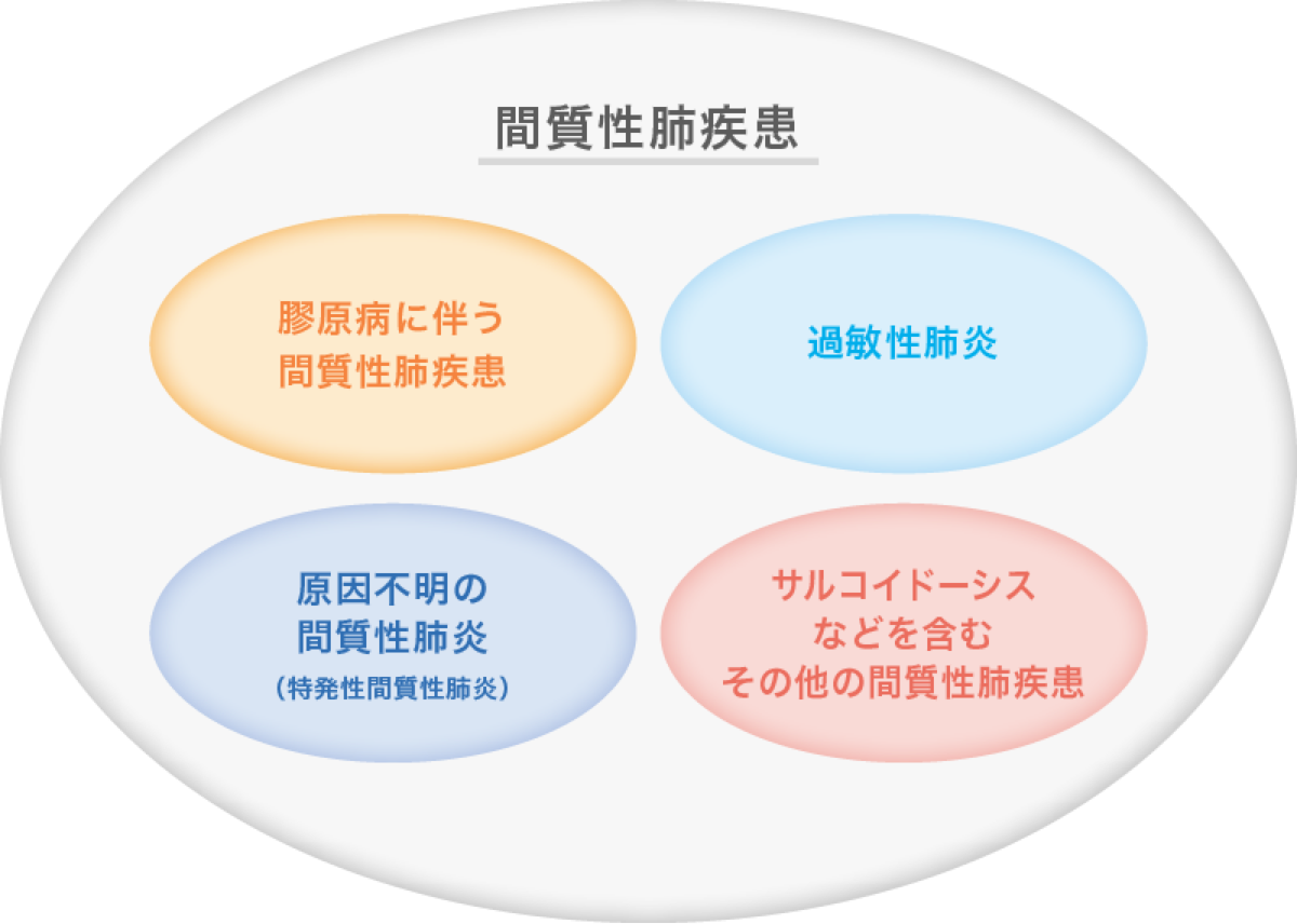 間質性肺疾患とは？