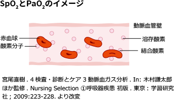 SpO2とPaO2のイメージ